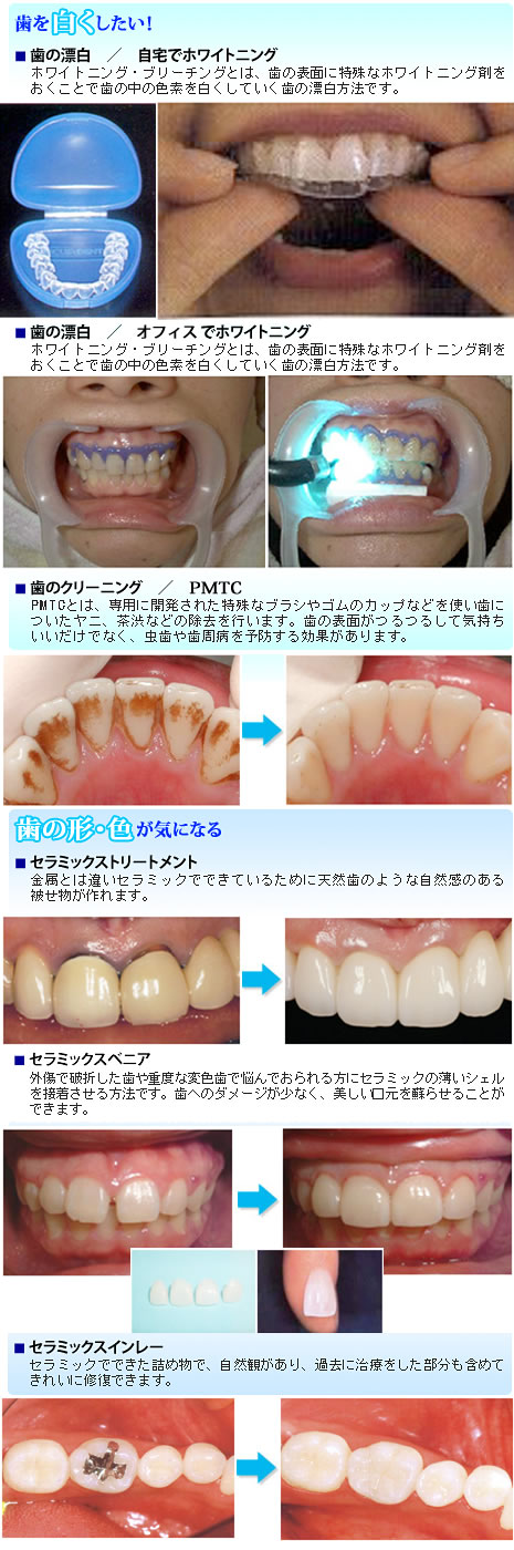 きれいな白い歯はじめてみませんか？